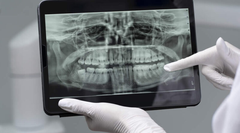 Dentista pediu exame de tomografia